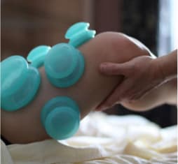 Orthopedic Cupping