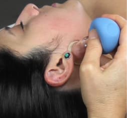 TMJ Treatment