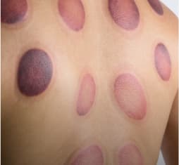 Detoxification Treatments