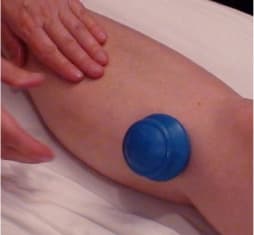 Trigger Points