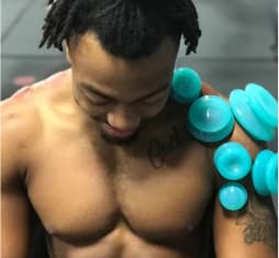 Sports Cupping