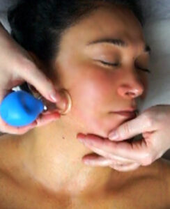 Facial Cupping Rejuvenation 1