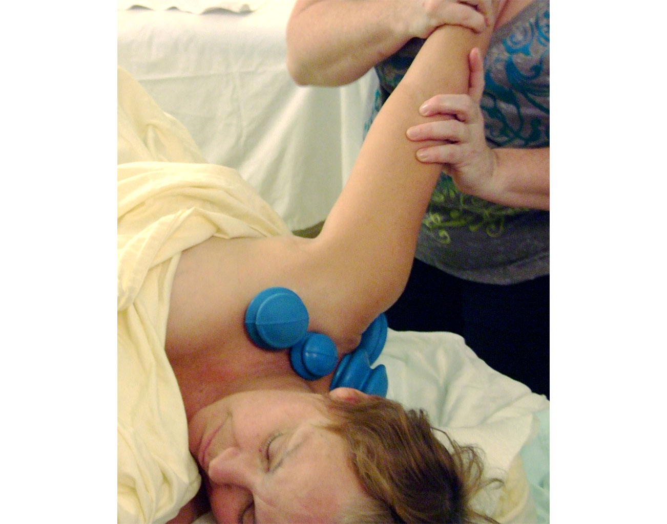 Dynamic Cupping Rotator Cuff